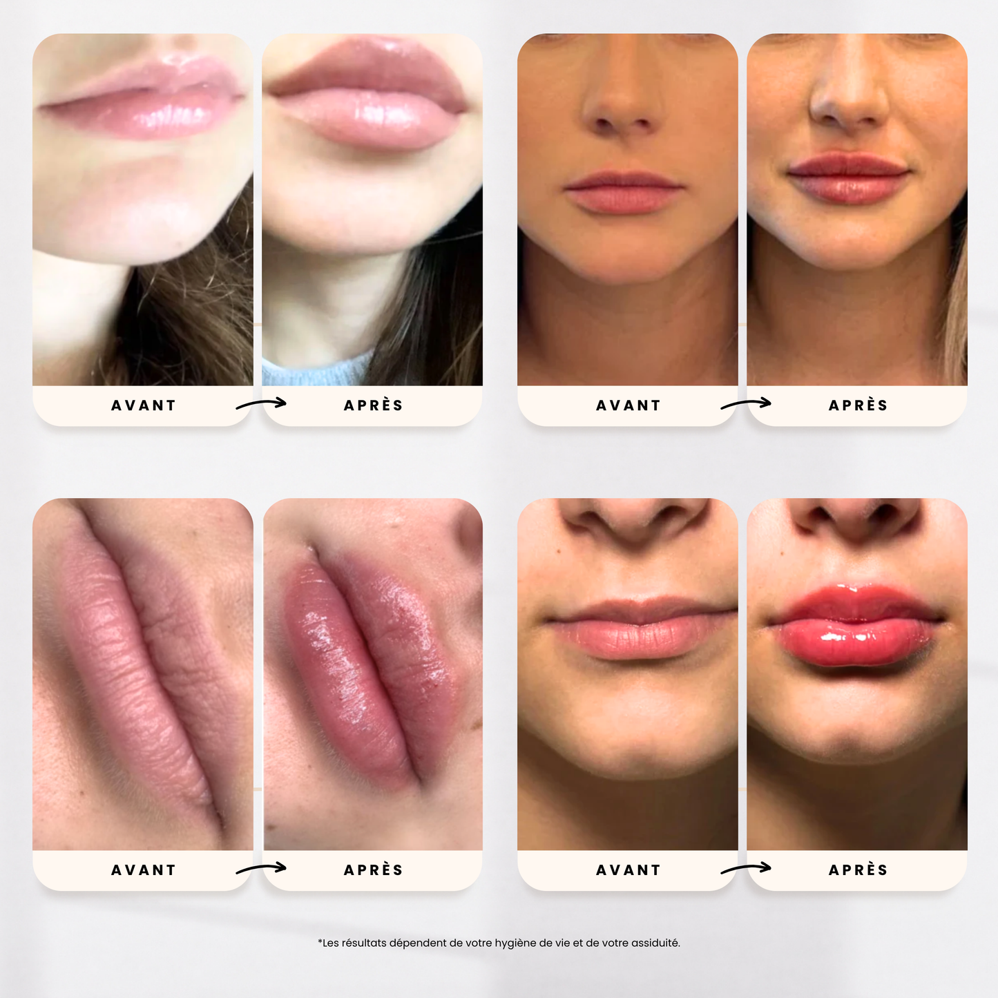 Sérum Repulpant - SweetGloss