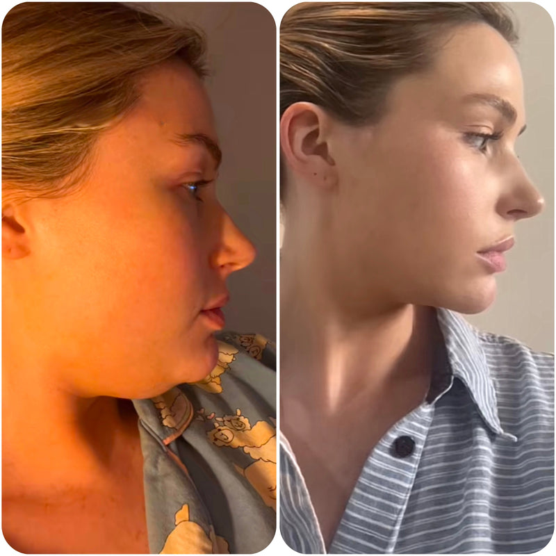Voici le avant après de Julie grace a notre gaine SweetLifty
