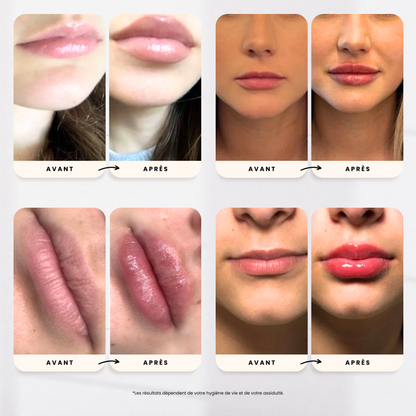 Sérum Repulpant - SweetGloss