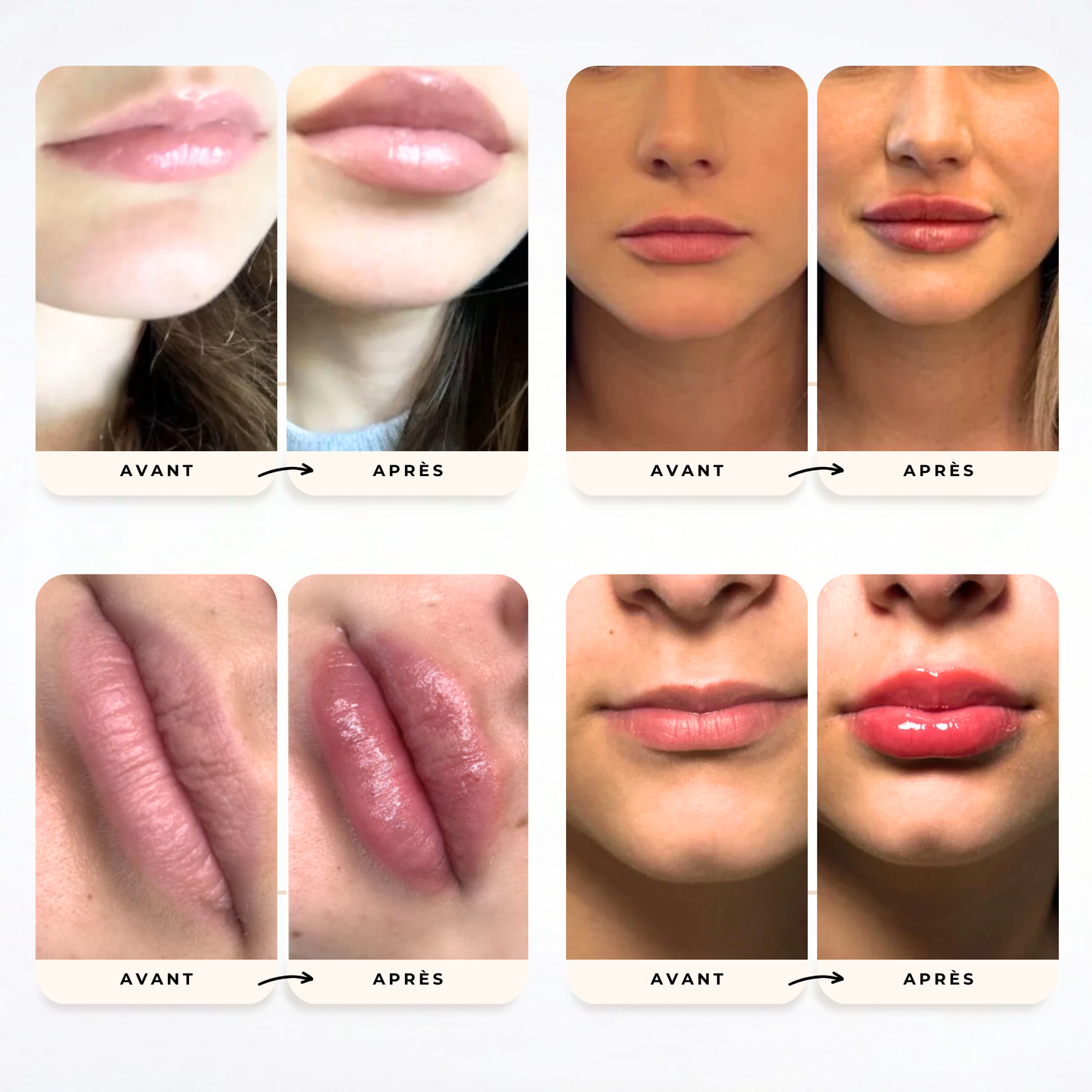 Sérum Repulpant - SweetGloss