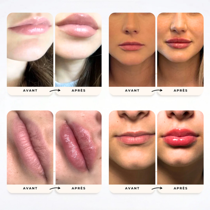 Sérum Repulpant - SweetGloss