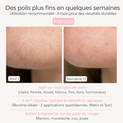 Huile pour réduire les poils – Formule 100 % naturelle