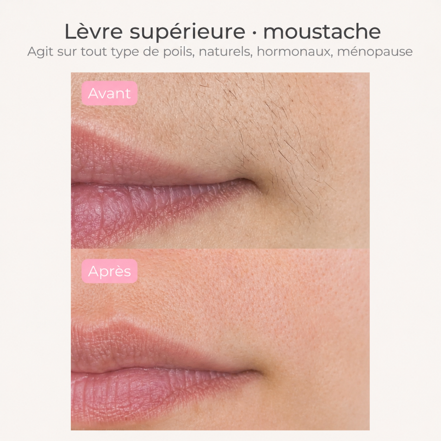 Huile pour réduire les poils – Formule 100 % naturelle