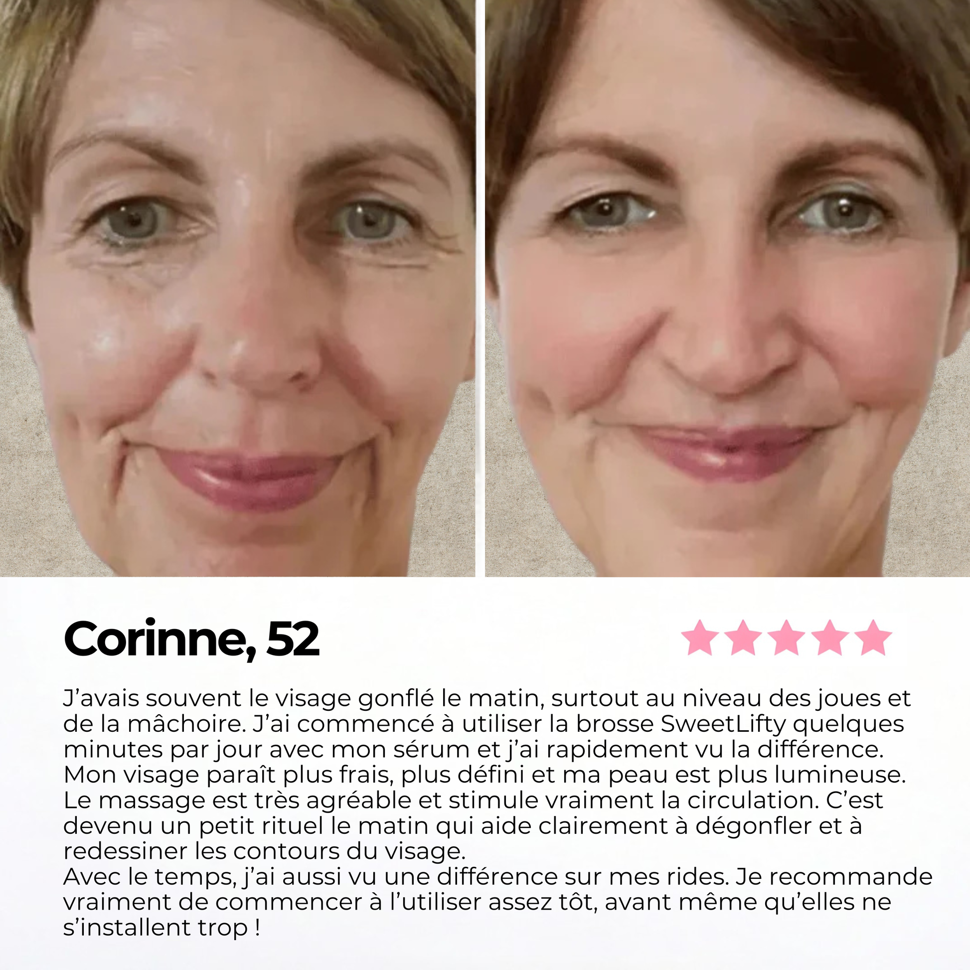 Avis de Corinne sur la brosse lymphatique SweetLifty avec photos avant après montrant un visage moins gonflé, des contours plus définis et une peau plus lumineuse.