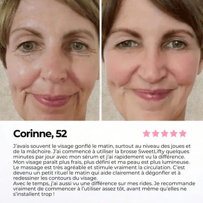Avis de Corinne sur la brosse lymphatique SweetLifty avec photos avant après montrant un visage moins gonflé, des contours plus définis et une peau plus lumineuse.