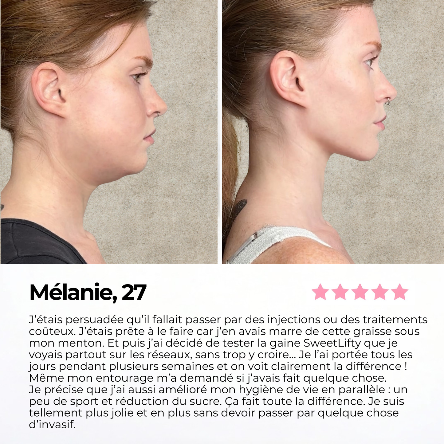 Avis de Mélanie sur la gaine SweetLifty avec photos avant après montrant un visage plus affiné et un ovale du visage mieux défini.