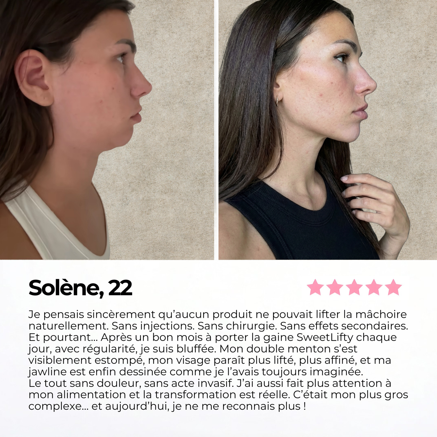 Avis de Solène sur la gaine SweetLifty avec photos avant après montrant un visage plus affiné et un ovale du visage mieux défini.