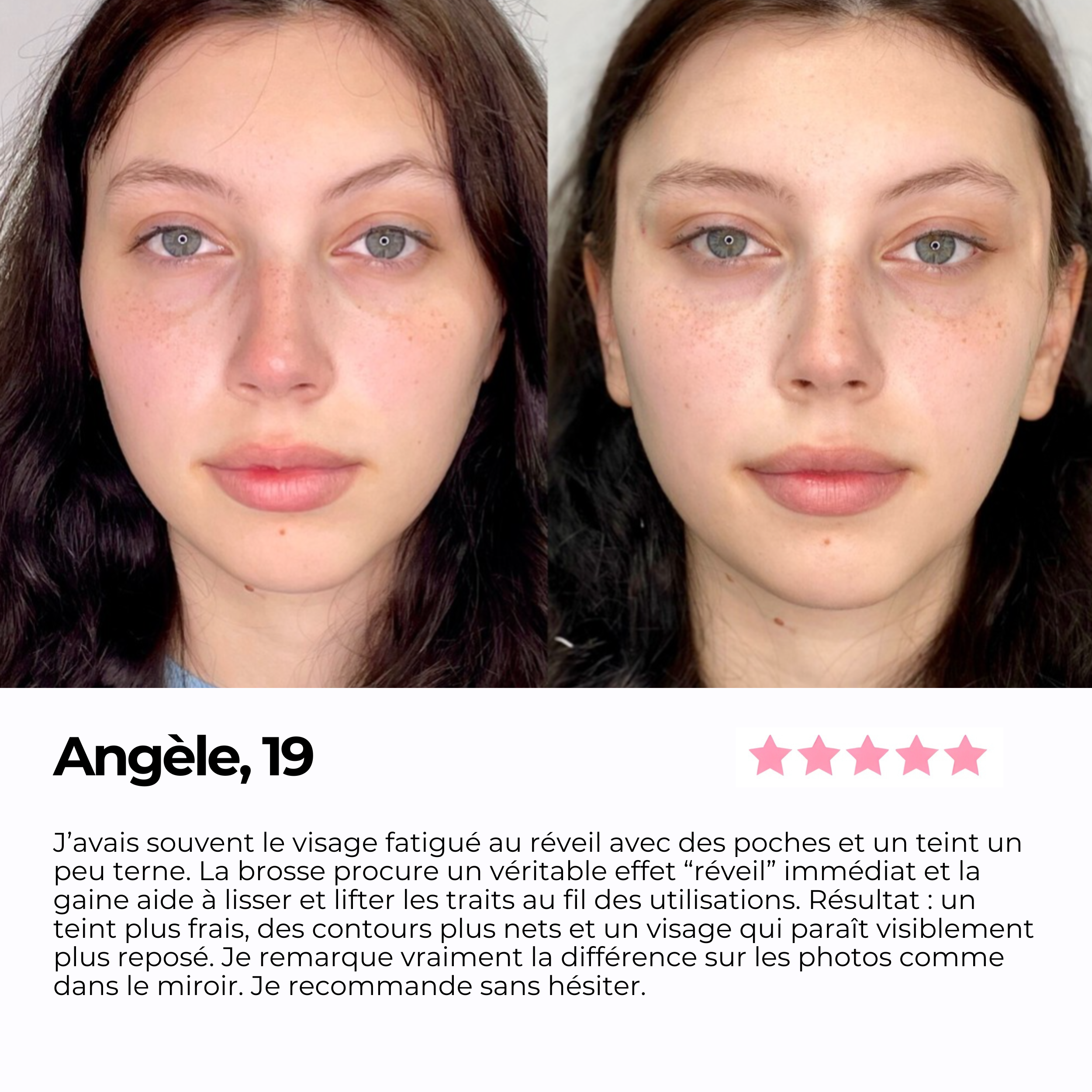 Avant/après d'une cliente de 19 ans après utilisation de la brosse lymphatique et de la gaine visage SweetLifty, accompagné d'un témoignage décrivant un visage plus frais, des traits plus définis et une apparence plus reposée.