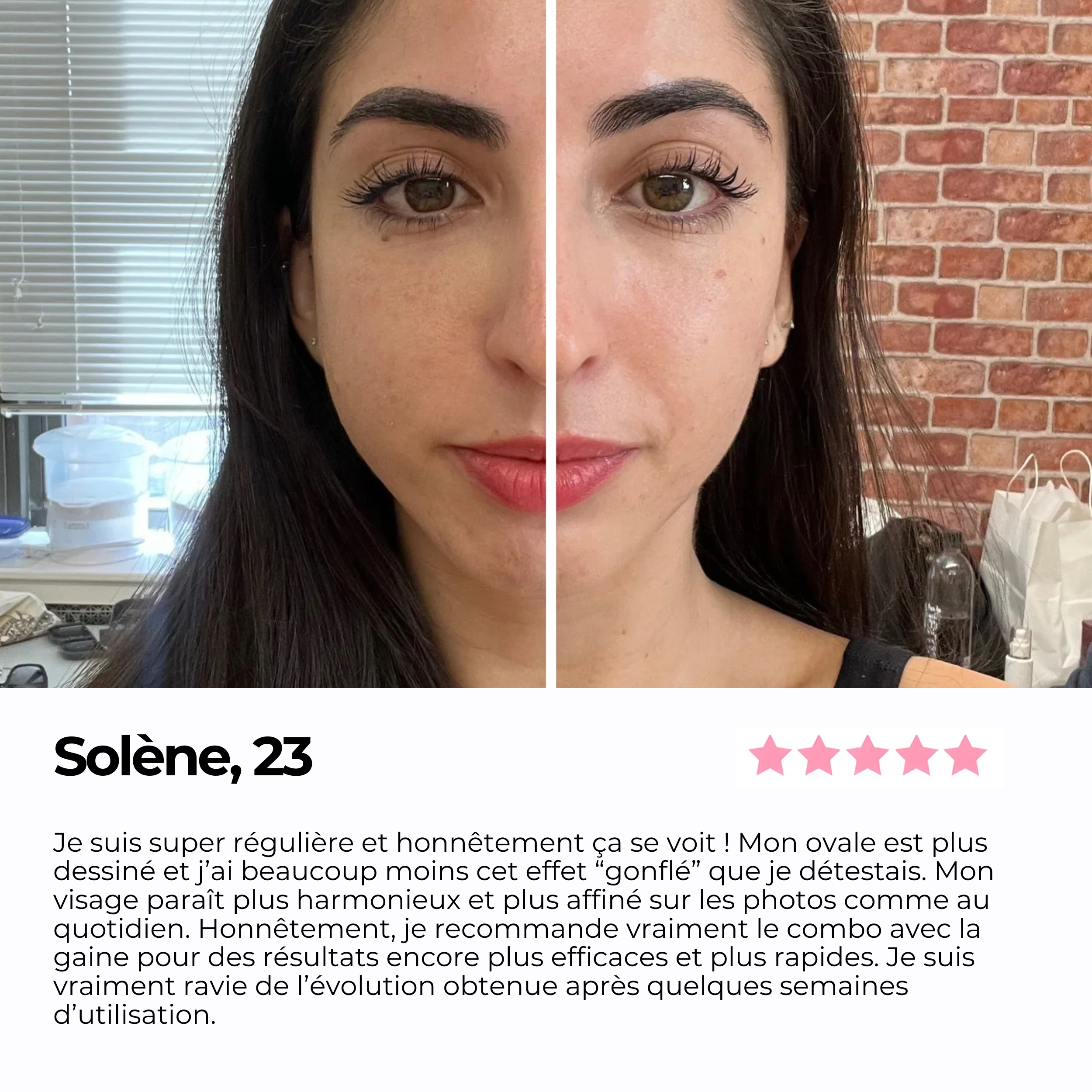 Avant/après d'une cliente de 23 ans après plusieurs semaines d'utilisation de la brosse lymphatique et de la gaine visage SweetLifty, avec un témoignage décrivant un visage moins gonflé, un ovale plus dessiné et des contours plus affinés.